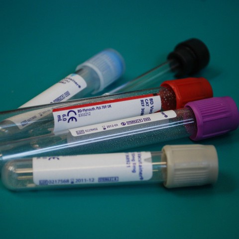 Pfizer-vaccin mogelijk maandag al goedgekeurd 